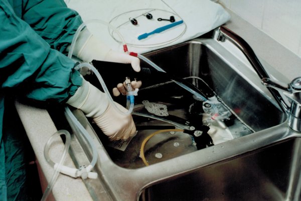 PSK-Endoscope-cleaning-close